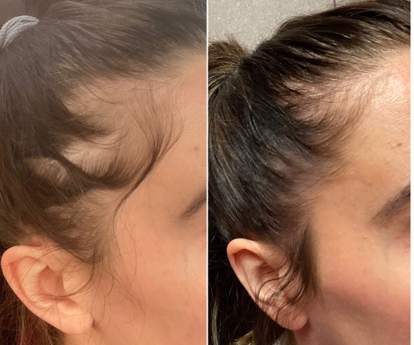 antes-x-depois-1.jpg