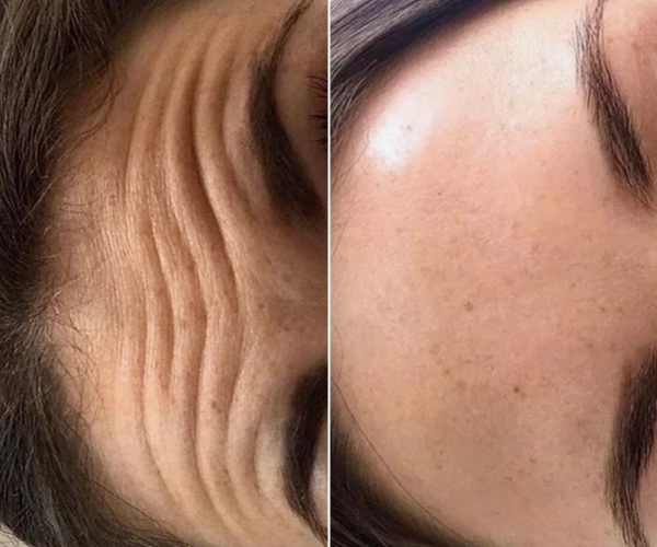 antes-x-depois-12.jpg