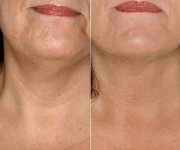 antes-x-depois-13.jpg