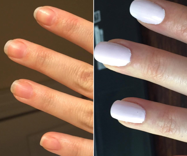 antes-x-depois-14.jpg