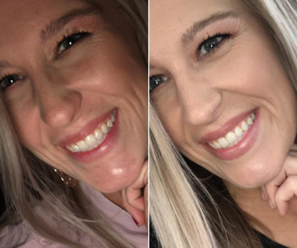 antes-x-depois-15.jpg