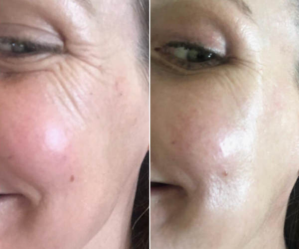 antes-x-depois-19.jpg
