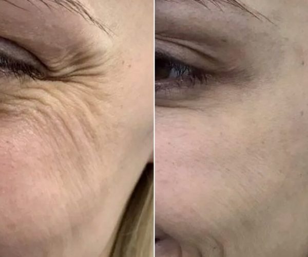 antes-x-depois-20.jpg