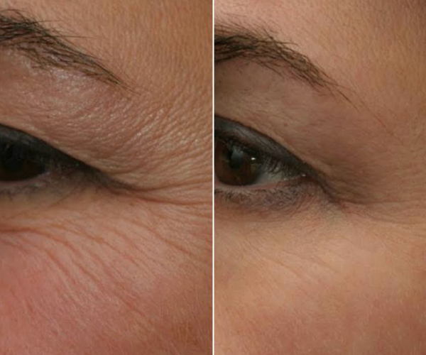 antes-x-depois-5.jpg