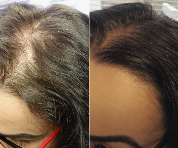 antes-x-depois-7.jpg